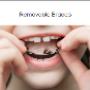 Removable Braces for every Circumstance.