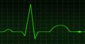 ECGs