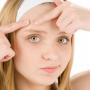 Acne Treatment