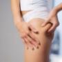 anti cellulite