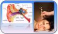 Ear Candling