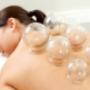 Cupping