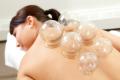 Cupping