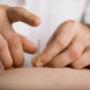 Dry Needling