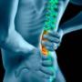 BACK PAIN