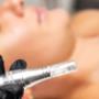 Experience the transformative power of medical microneedling at Beautique. Our advanced treatments stimulate collagen production, reduce fine lines and wrinkles, and improve skin texture and tone.
