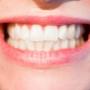 Cosmetic Dentist Ballincollig