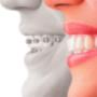 Orthodontist Ballincollig