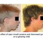 orthotropic treatment Cork