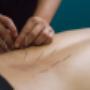 Dry Needling