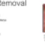 red vein removal