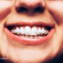Bagenalstown Dental Carlow