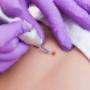 All Types Of Skin Lesions