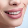 teeth whitening cork