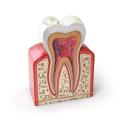 Root Canal Treatments