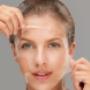 Chemical Face Peel