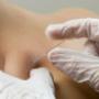 Dry Needling