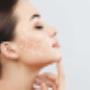 Anti Wrinkle Treatment, Lip Fillers Dublin, Dermal Fillers Dublin
Profhilo Treatment Dublin, Skin Rejuvenation, PDO Thread Lift
