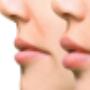 Anti Wrinkle Treatment, Lip Fillers Dublin, Dermal Fillers Dublin
Profhilo Treatment Dublin, Skin Rejuvenation, PDO Thread Lift