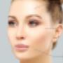 Anti Wrinkle Treatment, Lip Fillers Dublin, Dermal Fillers Dublin
Profhilo Treatment Dublin, Skin Rejuvenation, PDO Thread Lift