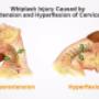 WHIPLASH INJURY
