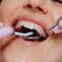 white fillings/safe mercury amalgam