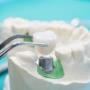 Dental Crowns