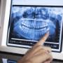 Dental X-Rays