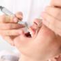 Teeth Cleaning