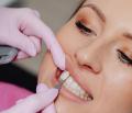 Dental-Veneers