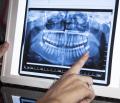Dental-X-Rays