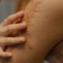 ScarWork