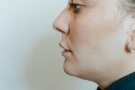 Aesthetic clinic in Cork