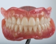 New Denture Design Practice Top